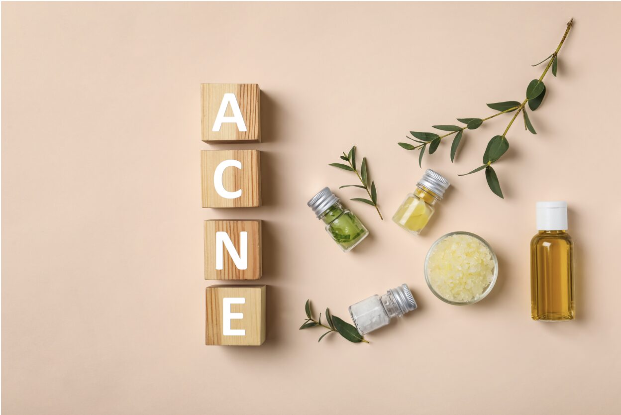 Nature’s Arsenal: Effective Natural Remedies for Acne 